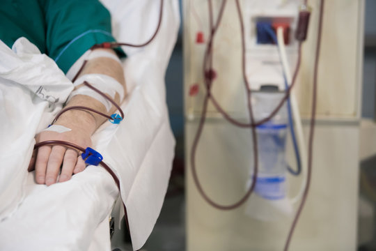 Haemodialysis